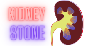 Read more about the article Renal Calculus -The Kidney Stone